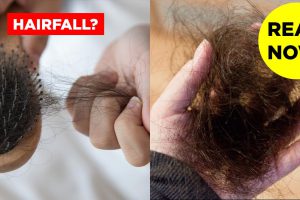 Things that worked for me to stop hair fall